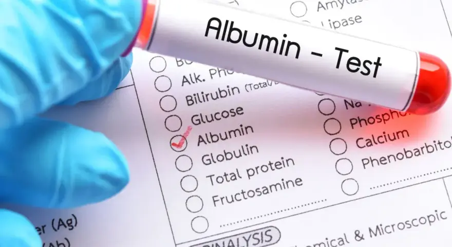 Rękawiczka w niebieskiej rękawiczce trzyma probówkę z napisem "Albumin - Test". Obok zaznaczono pole "Albumin" na liście badań.