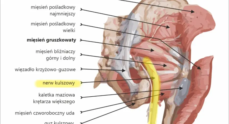 Jak złagodzić ból pośladków po zastrzykach – skuteczne sposoby i porady