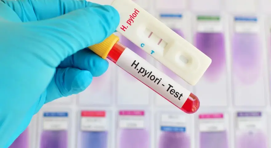Rękawiczka trzyma probówkę z krwią i test H. pylori. Czasem objawy psychiczne mogą być związane z tą infekcją.