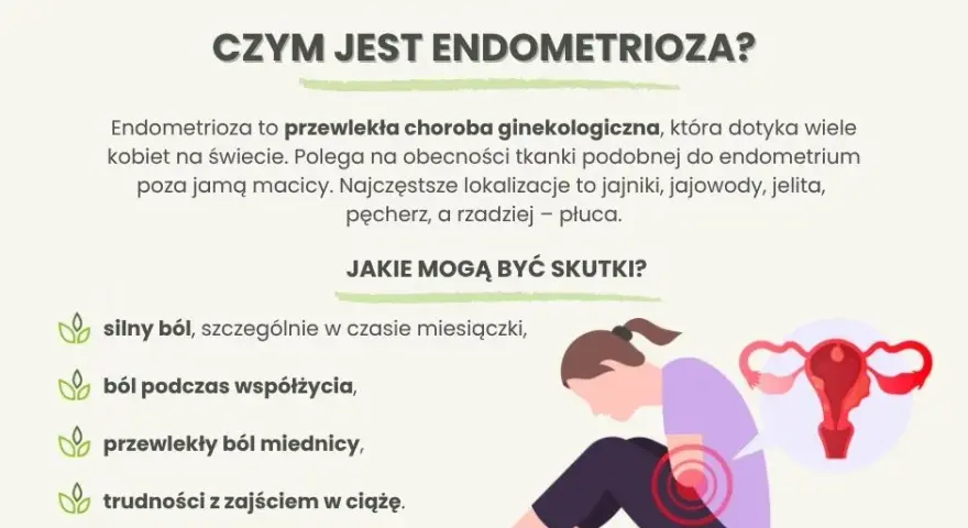 Endometrioza objawy forum: co naprawdę musisz wiedzieć o bólu