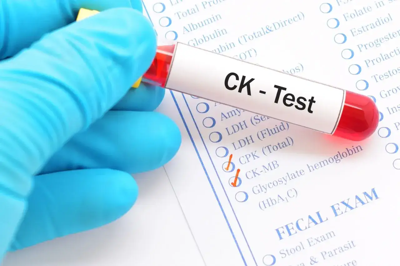 Rękawiczka trzyma probówkę z krwią do testu CK. Na formularzu zaznaczono CK-MB, co może wskazywać na badanie kinazy kreatynowej.