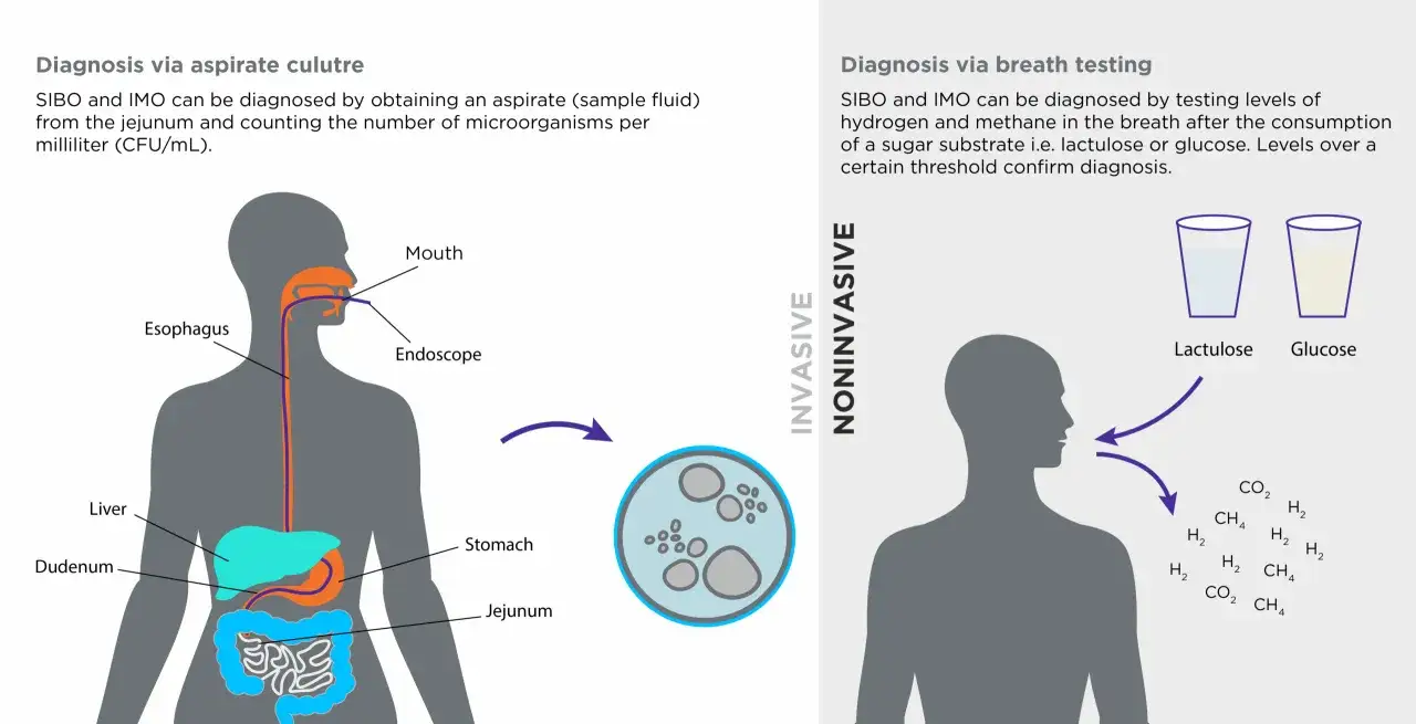SIBO co to? Dwie metody diagnozy: inwazyjna (aspirat z jelita cienkiego) i nieinwazyjna (test oddechu po spożyciu cukru).