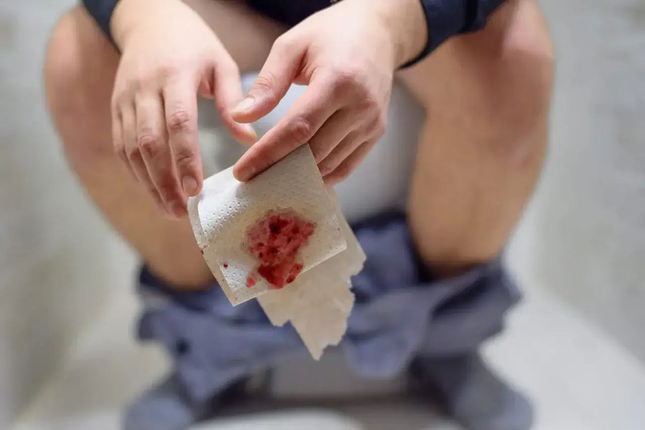 Dłoń trzymająca papier toaletowy z krwią. Częste gazy i krew mogą być objawem raka jelita grubego.