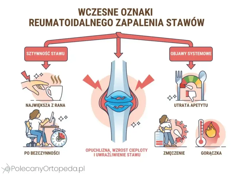 Wczesne oznaki reumatoidalnego zapalenia stawów: sztywność, opuchlizna, utrata apetytu, zmęczenie, gorączka.